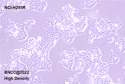 Human adrenocortical adenocarcinoma cells-BNCC