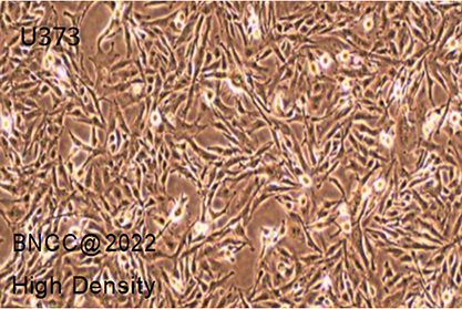 Human glioma cells-BNCC