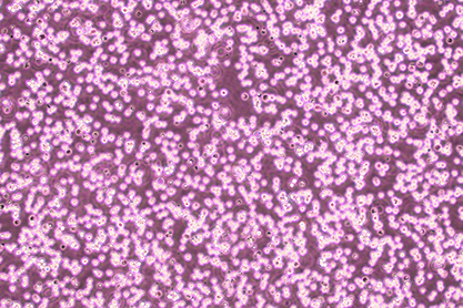 Mouse lymphoid tumor cells-BNCC