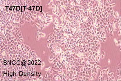 Human breast ductal cancer cells-BNCC