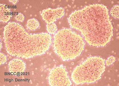 Human T-lymphocyte leukemia cells-BNCC