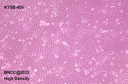 Human esophageal cancer cells-BNCC