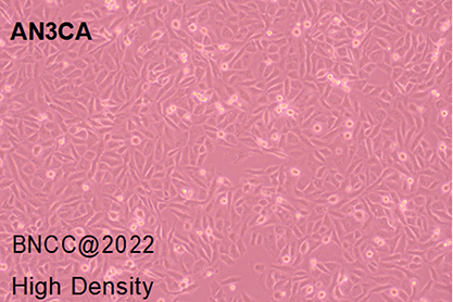 Human endometrial adenocarcinoma (metastatic) cells-BNCC