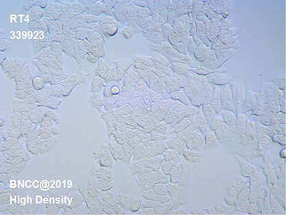 Human bladder transitional cell papilloma cells-BNCC