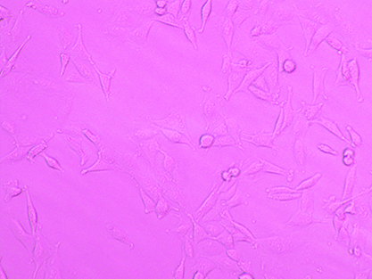 Human Breast Epithelial Cells Integrating SV40 Gene-BNCC