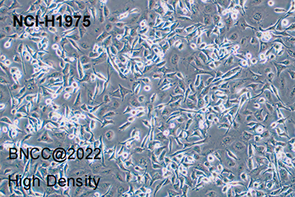 Human lung adenocarcinoma cells-BNCC
