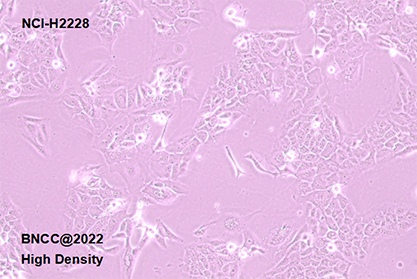 Human non-small cell line lung cancer cells-BNCC