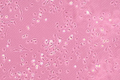 Human umbilical vein endothelial (bladder cancer) cells-BNCC