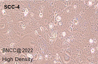 Human tongue squamous cell carcinoma-BNCC