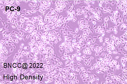 Human lung adenocarcinoma cells-BNCC
