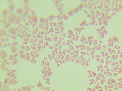 Escherichia coli EIEC-BNCC