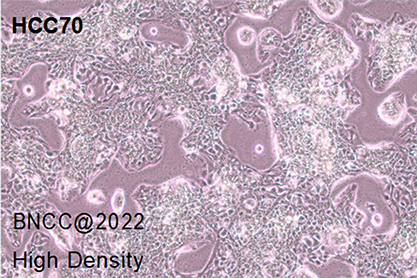 Human breast ductal cancer cells-BNCC