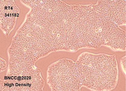 Human bladder transitional cell papilloma cells-BNCC