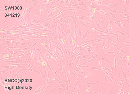 Human brain astroglia cells-BNCC
