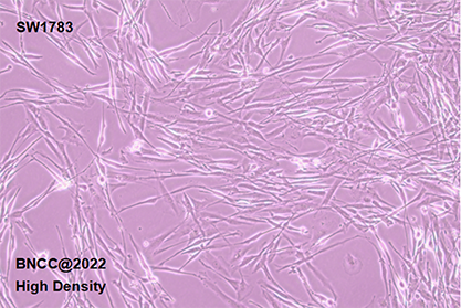 Human brain astroglia cells-BNCC