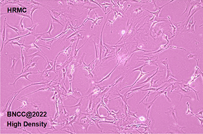 Human glomerular mesangial cells-BNCC