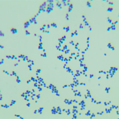 Microbacterium testaceum (Komagata and Iizuka) Takeuchiand Hatano-BNCC