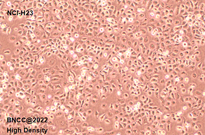 Human non-small cell lung cancer cells-BNCC