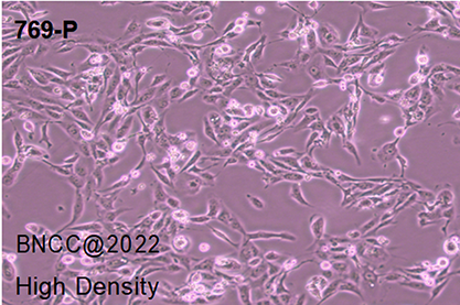 Human renal cell adenocarcinoma cell-BNCC