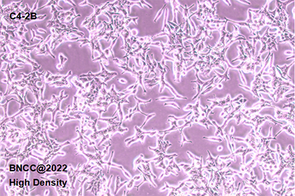 Human prostate cancer cells-BNCC