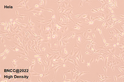 Human cervical cancer cells-BNCC