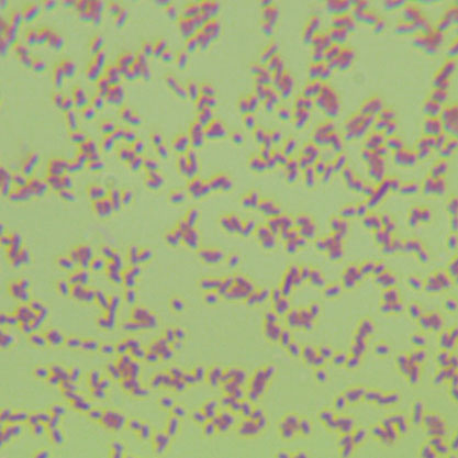 Escherichia coli EHEC-BNCC