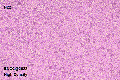 Mouse liver cancer cells-BNCC