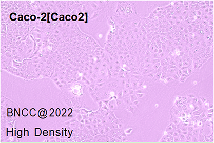 Human colorectal adenocarcinoma cells-BNCC