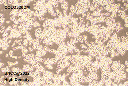 Human colon cancer cells-BNCC