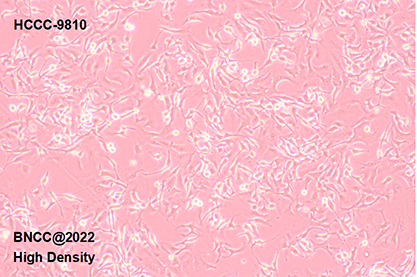 Human bile duct cell type liver cancer cells-BNCC