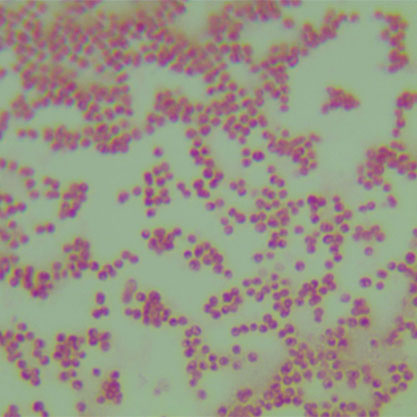 Paracoccus tibetensis-BNCC
