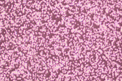 Mouse myeloid mononuclear leukemia cells-BNCC