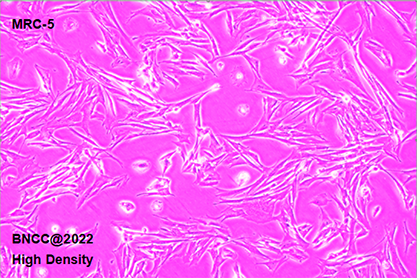 Human embryonic lung fibroblasts-BNCC