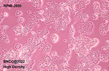 Human nasal epithelial cells-BNCC