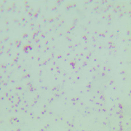 Neisseria meningitidis-BNCC