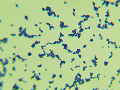 Streptococcus sobrinus-BNCC