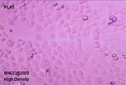 Human pancreatic ductal adenocarcinoma cells-BNCC