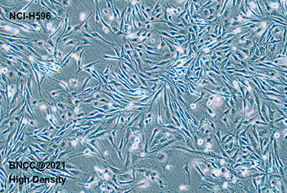 Human lung adenosquamous carcinoma cell-BNCC