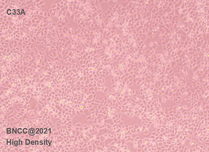 Human cervical cancer cells-BNCC