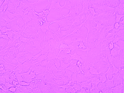 Mouse mammary tumor cells-BNCC