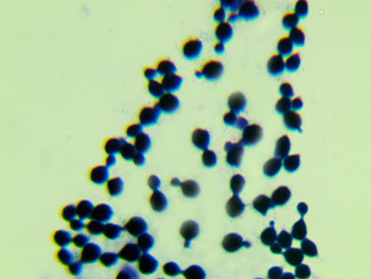 Cryptococcus gattii (Vanbreus. & Takashio)-BNCC