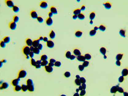 Cryptococcus tetragattii-BNCC