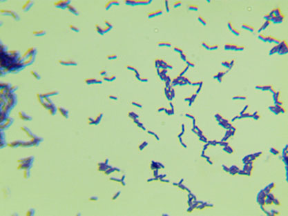 Lactobacillus jens-BNCC