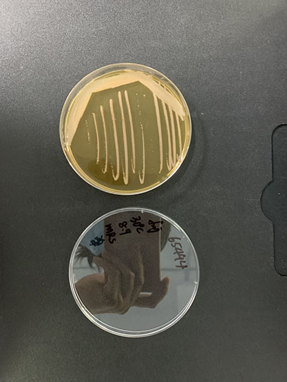 Acetobacter cerevisiae-BNCC