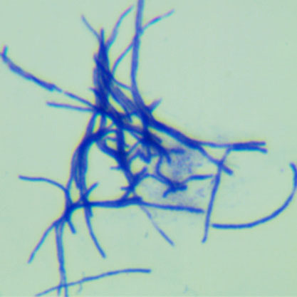 Streptomyces caespitosus-BNCC