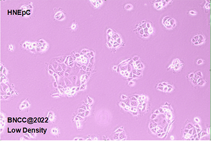 Human nasal mucosal epithelial cells-BNCC