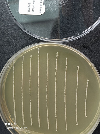 Streptococcus agalactiae-BNCC