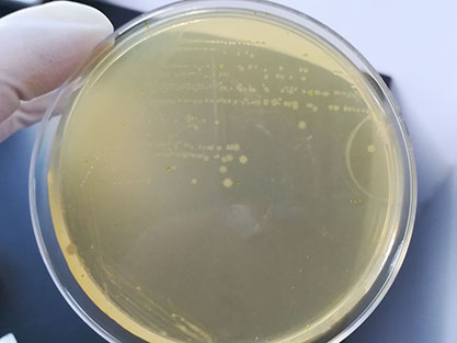 Clostridium caseate-BNCC