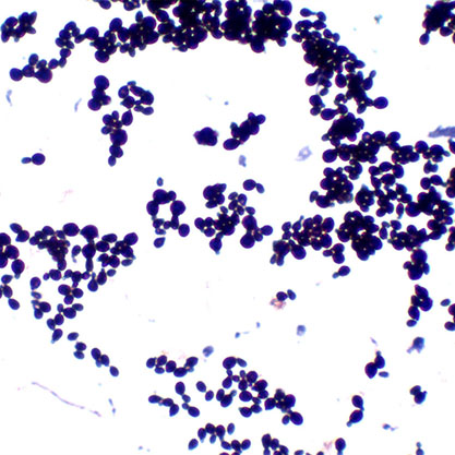 Malassezia sympodialis-BNCC