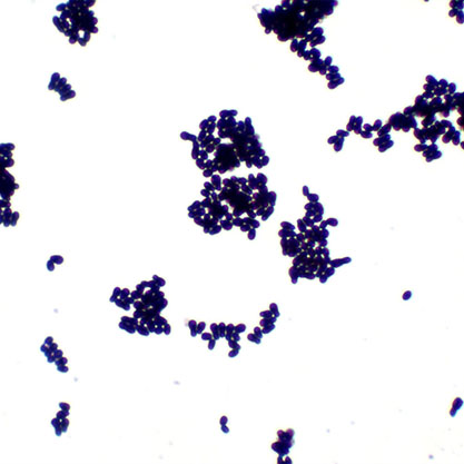 Malassezia slooffiae-BNCC